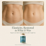 Elastura — Marine Elastin Peptide