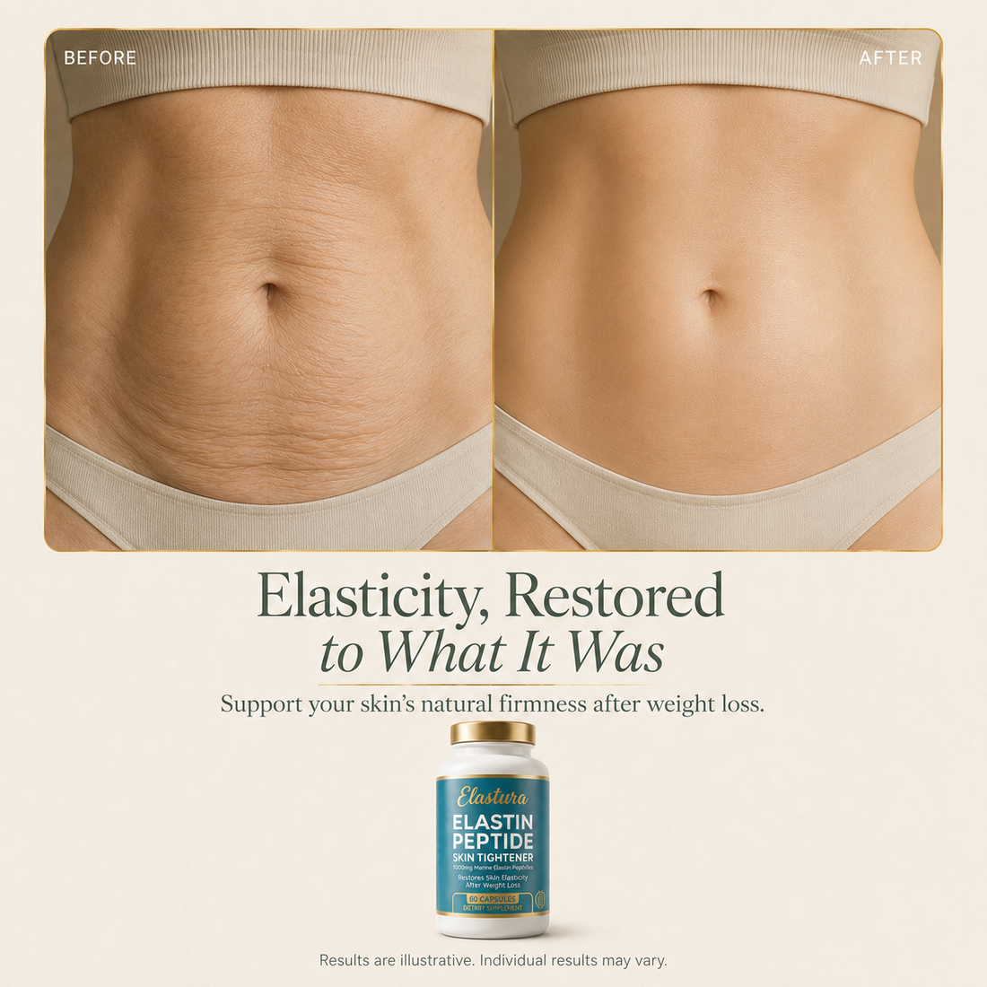 Elastura — Marine Elastin Peptide